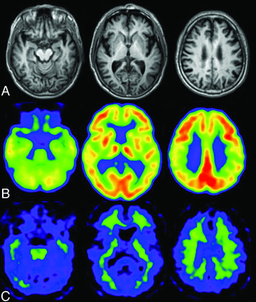 Fig 2.