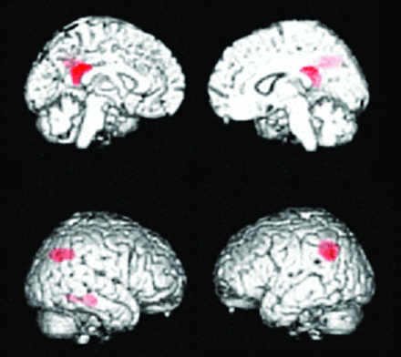 Fig 3.