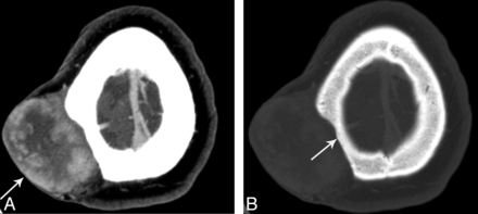 Fig 1.