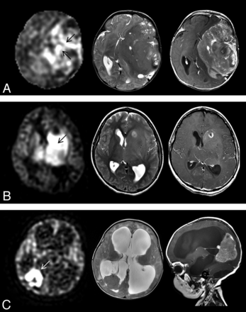 Fig 3.