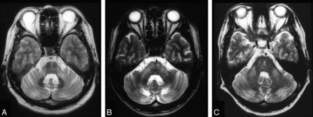 Fig 4.