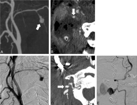 Fig 2.