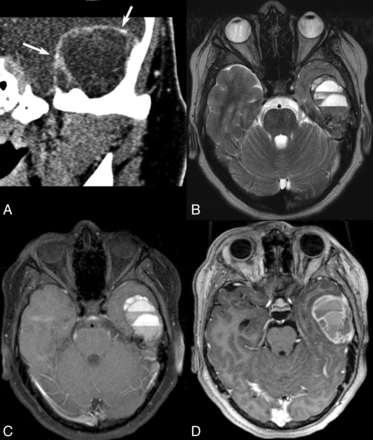 Fig 2.