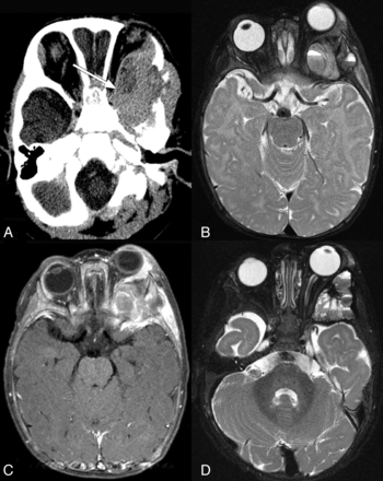 Fig 3.