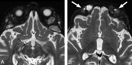 Fig 4.