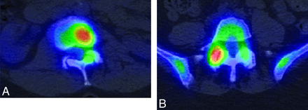 Fig 4.