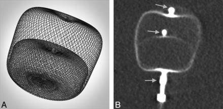 Fig 1.