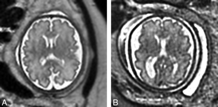 Fig 1.