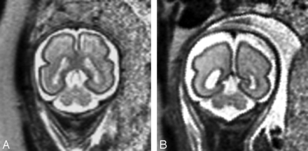 Fig 2.