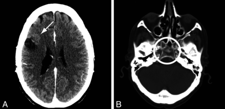 Fig 1.