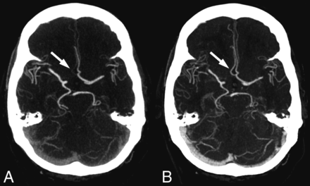 Fig 3.