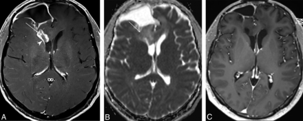 Fig 2.