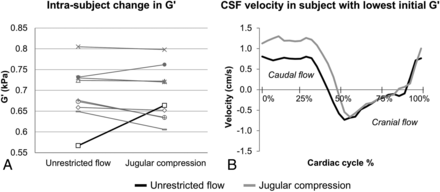 Fig 4.