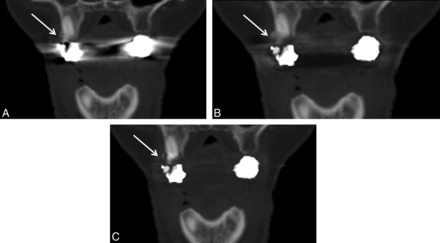 Fig 4.