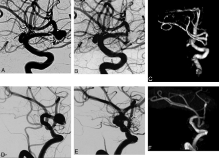 Fig 3.