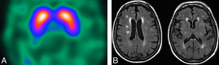 Fig 10.