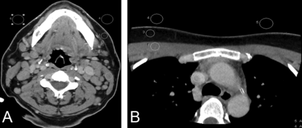 Fig 1.