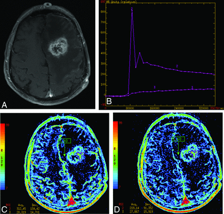 Fig 4.