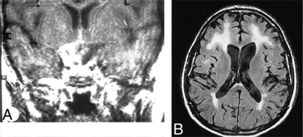 Fig 2.