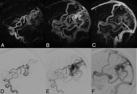 Fig 4.