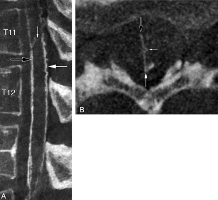 Fig 5.