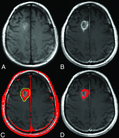 Fig 1.