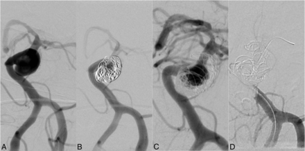 Fig 1.