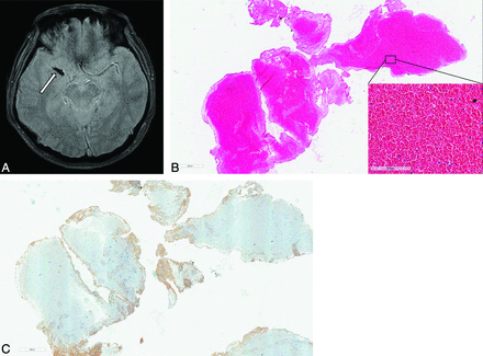 Fig 3.