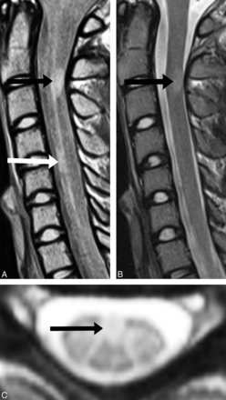 Fig 4.