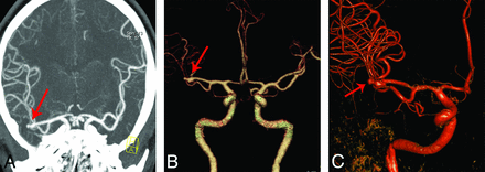 Fig 2.