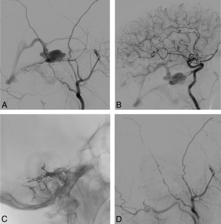 Fig 3.