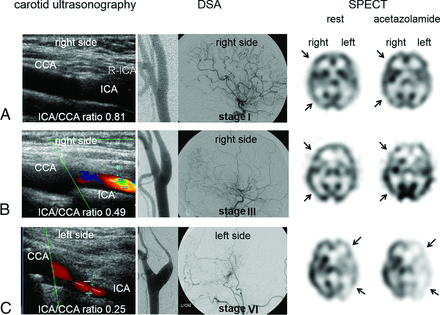 Fig 4.