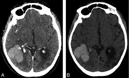 Fig 1.