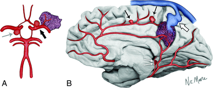 Fig 1.