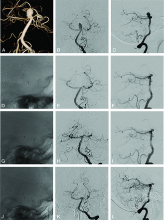 Fig 2.