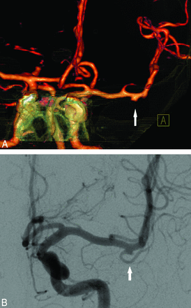 Fig 3.