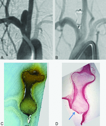 Fig 1.