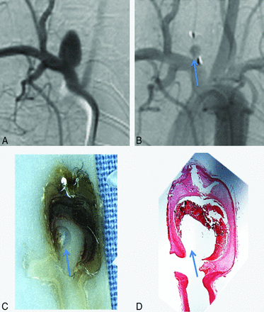 Fig 2.