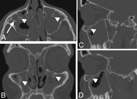 Fig 5.
