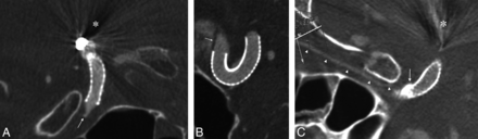 Fig 1.