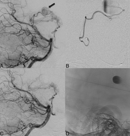 Fig 1.