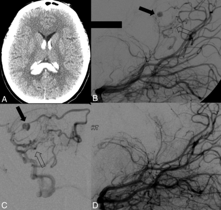 Fig 2.