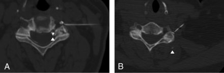 Fig 6.