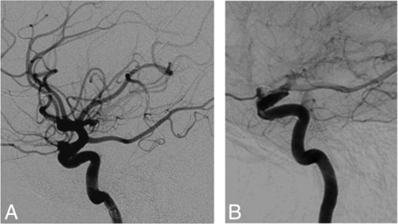 Fig 3.