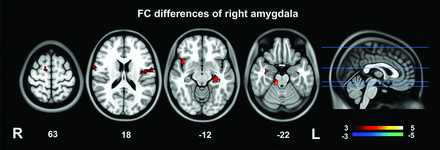 Fig 2.