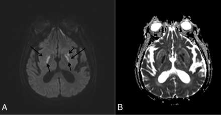 Fig 3.