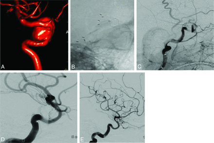 Fig 4.