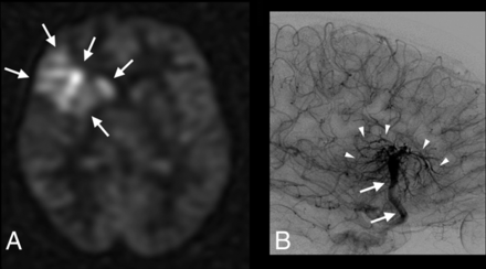 Fig 2.