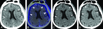 Fig 2.