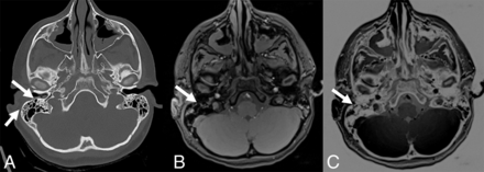 Fig 2.